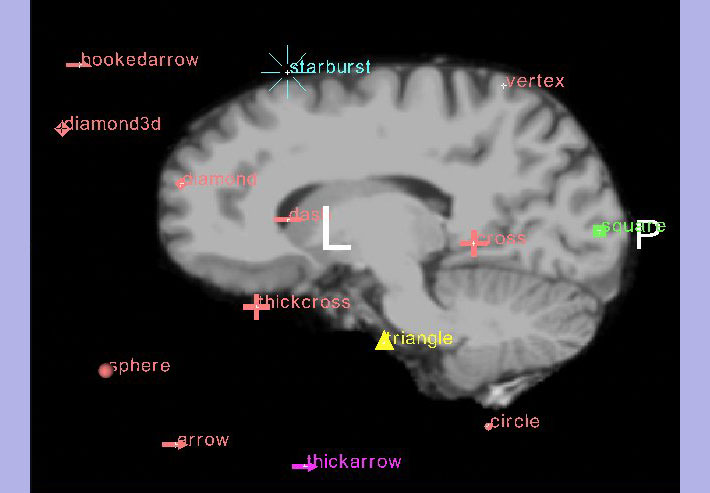 Image:FiducialGlyphs.jpg