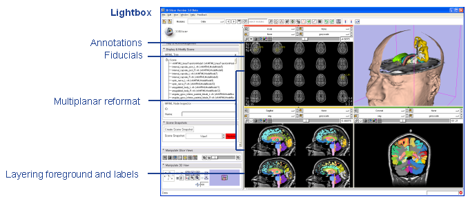 Image:Annotated_Lightbox.png