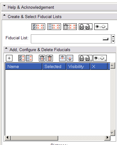 Image:UIDesignSlicer3.4FiducialsGUIDraft.png