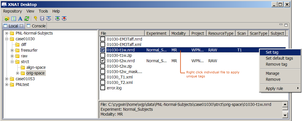 image:XNDsettag1.png