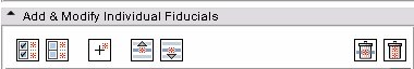 Image:SlicerFiducialsAddModifyIndividualFiducials-3.4.jpg