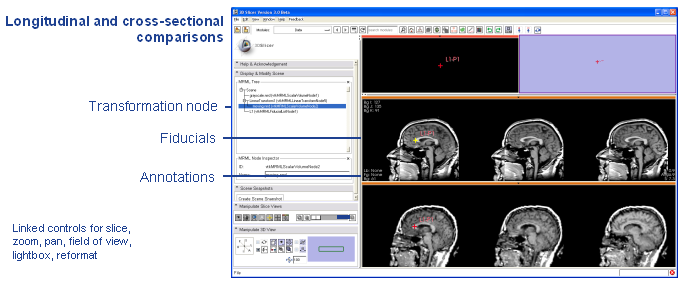 Image:Annotated_Longitudinal_and_cross-sectional_comparisons.png