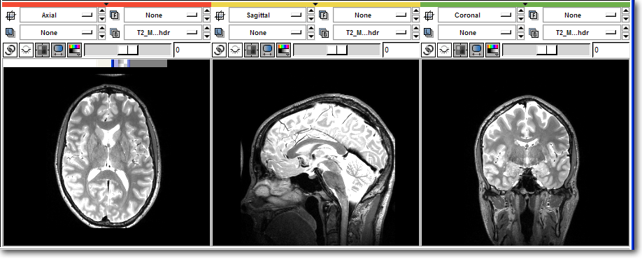 Image:PythonBefore.png
