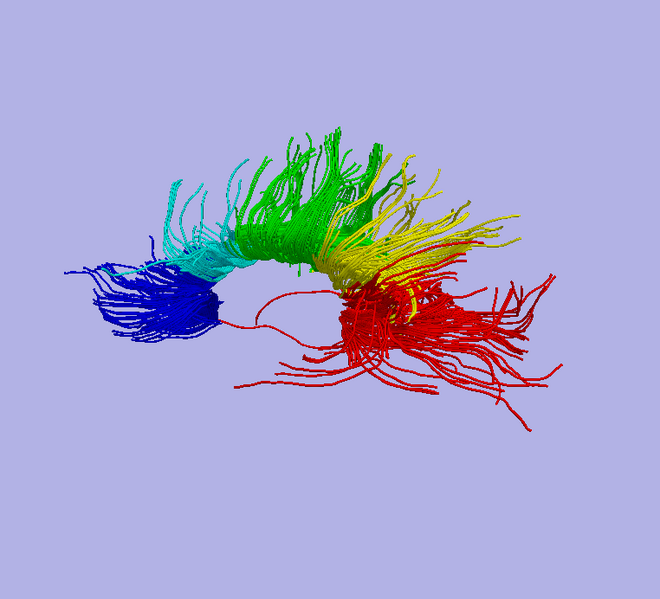 File:Training4DTI.PNG