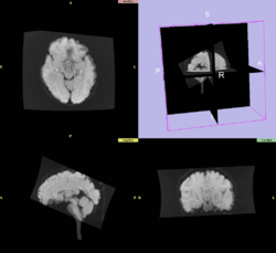 Results using slicer2