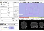 Slicer3 Grid Integration