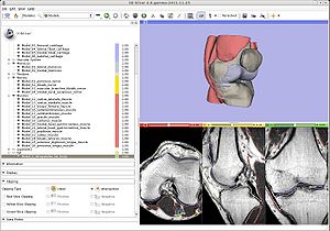 Knee Atlas Models