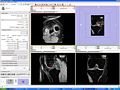 Thumbnail for version as of 17:14, 8 May 2009