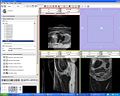 Thumbnail for version as of 02:48, 30 May 2009