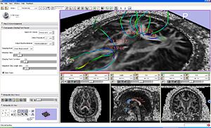 fiducial seeding