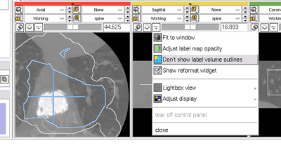 Menu to show label maps as outlines.