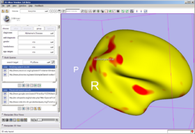 Caption: Search interface, Qdec population statistics analysis
