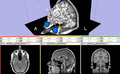 Thumbnail for version as of 16:20, 25 May 2010