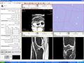 Thumbnail for version as of 23:21, 7 May 2009