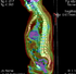 RegLib C08: PET-CT1