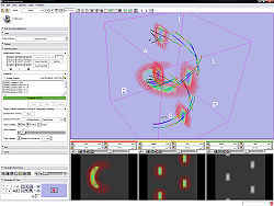 Diffusion Editor, showing tracts and glyphs on helix example