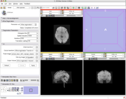 Results using slicer3 as of 2008-04-10