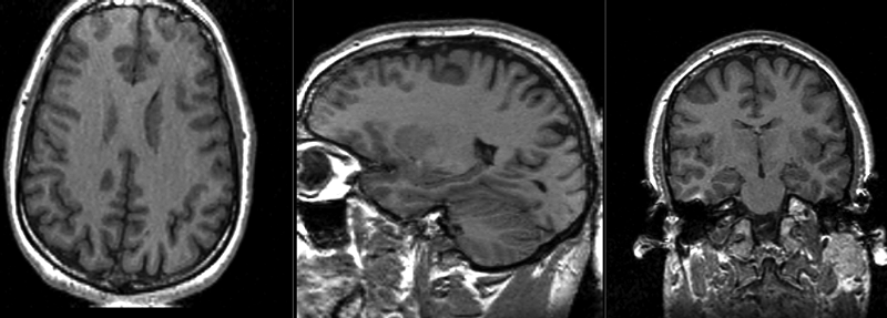 File:RegLib C10 registered2 Affine.gif