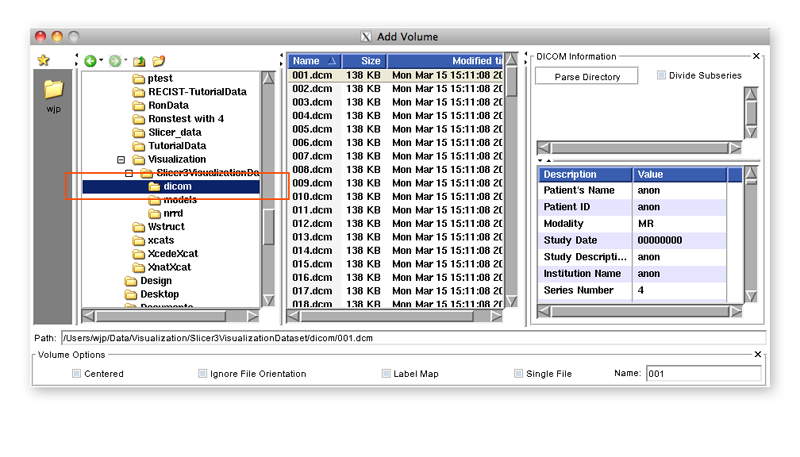 Data-3.6-AddDICOMVolume2.png