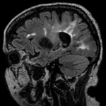 this is the moving image, to be aligned with the reference on the left