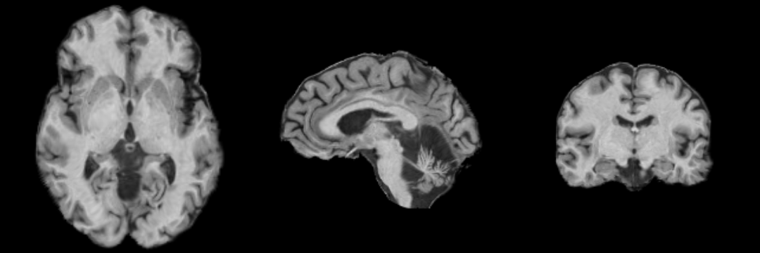 MRI-Human-Brain-Parcellation T1 3x360x360.png