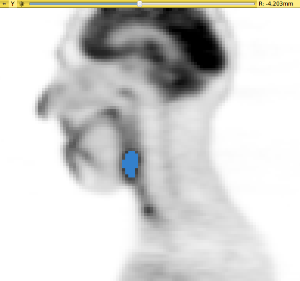 File:QuantitativeIndicesTool Screenshot2.png