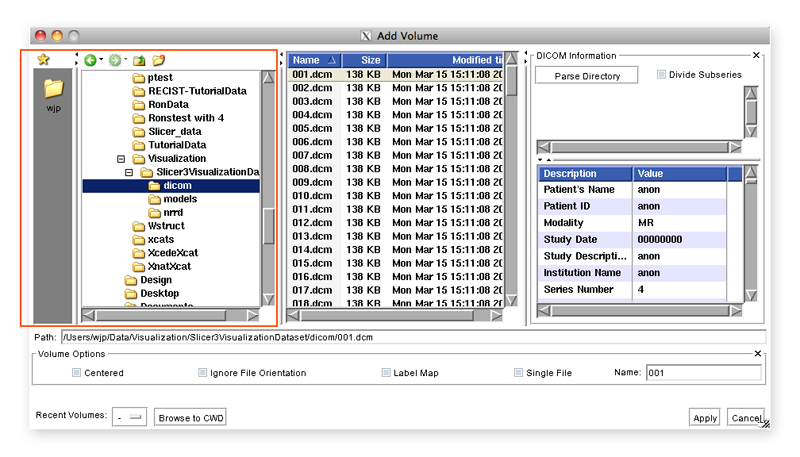Data-3.6-AddDICOMVolume1.png