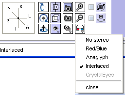 The Stereo Viewing Icon