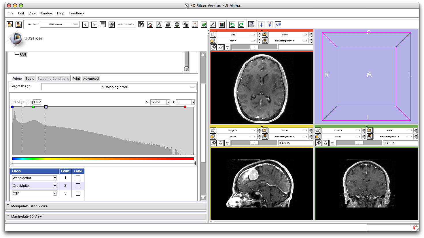 EMSegment visualization of the global prior parameter value
