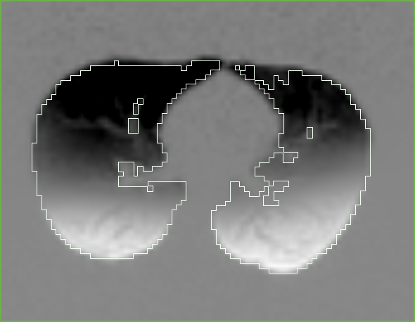 File:N4 he subtract.png