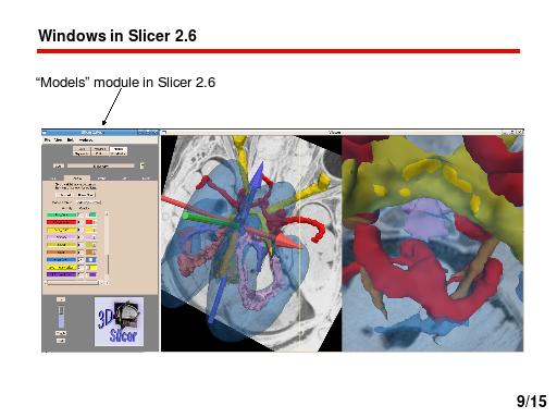 File:Slicer igt img11.jpg