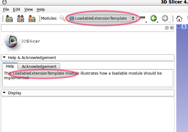File:Slicer-r19441-LoadableExtensionTemplate-screenshot.png