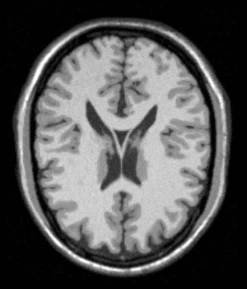 File:OriginalBrainWebImage.jpg