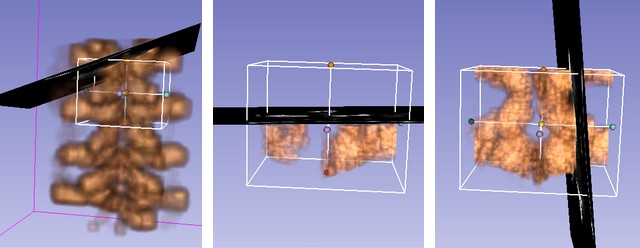 File:PlusRemote phantom scan.jpg