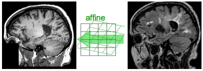 Registration Library Case 02: Brain Affine