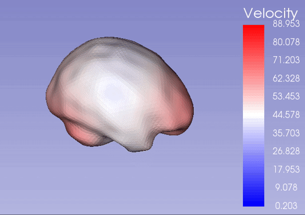 File:BrainGrowth RegressionSequence.gif