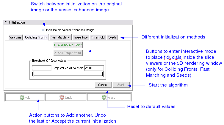 VMTKLevelSetSegmentation initialization panel.png
