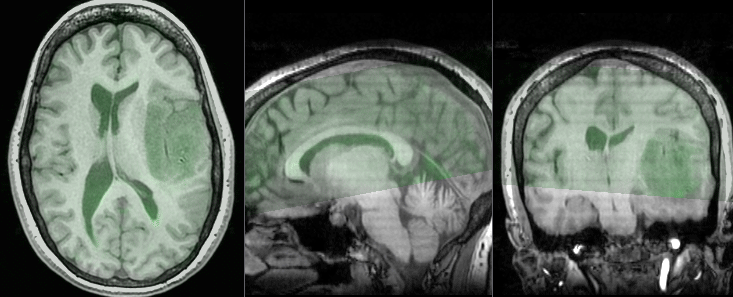 File:RegLib C09 registered1 rigid.gif