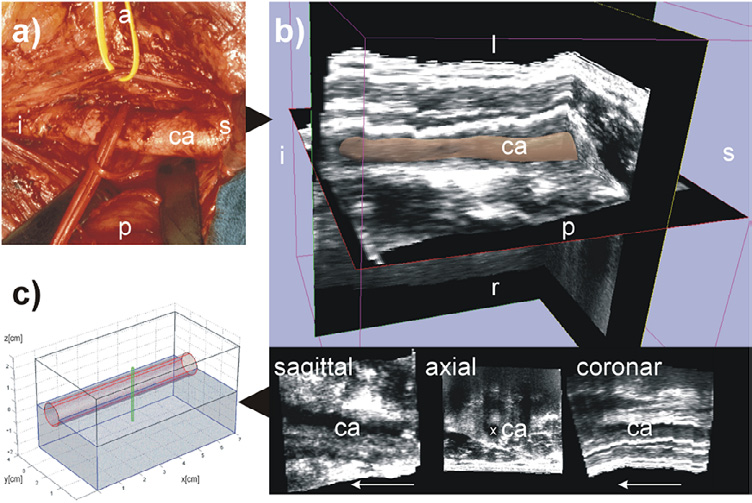 File:Mohammed-BiomedEngOnline2005-fig1.png