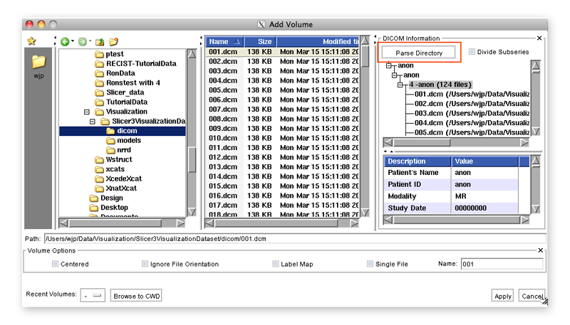 Data-3.6-AddDICOMVolume3.png