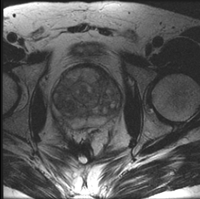RegLib C07: Prostate MRI pre/post