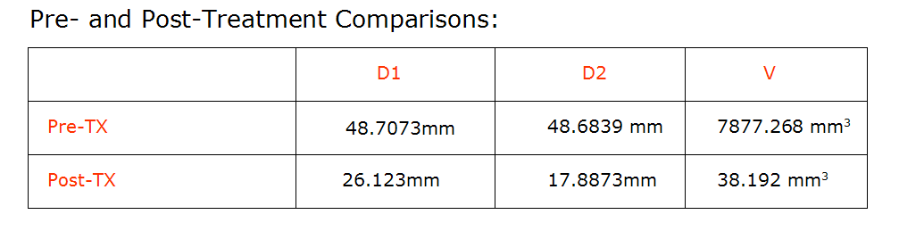 pre- versus post-TX statistics