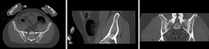 File:RegLib C44 unregistered.gif