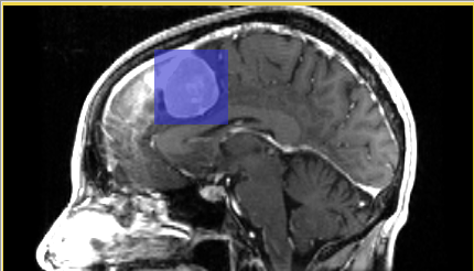 ChangeTracker Step2 2.png