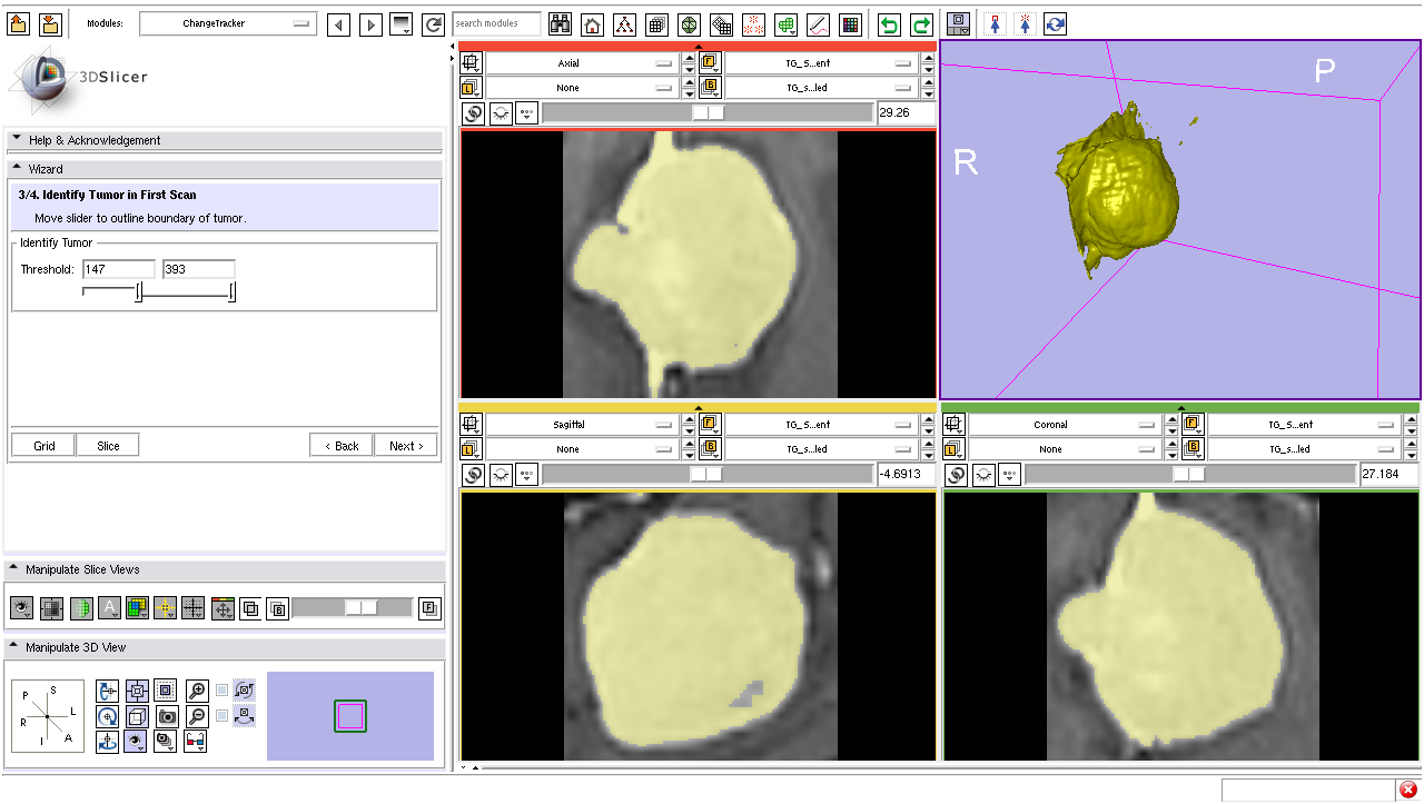 ChangeTracker Step3.png