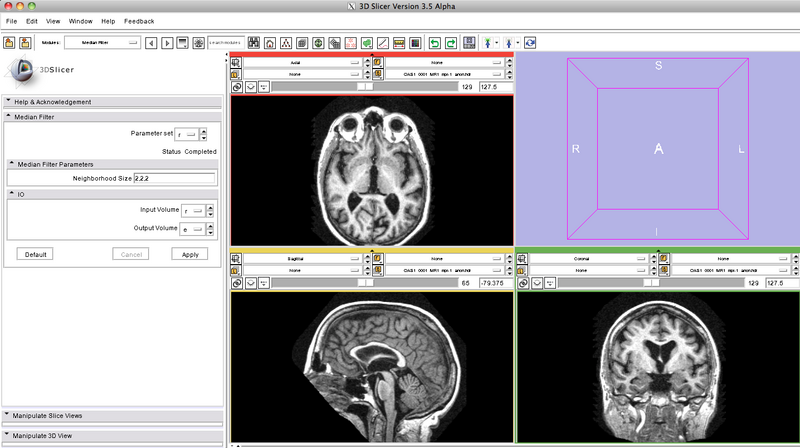 File:MedianFilter-3-6-input.png