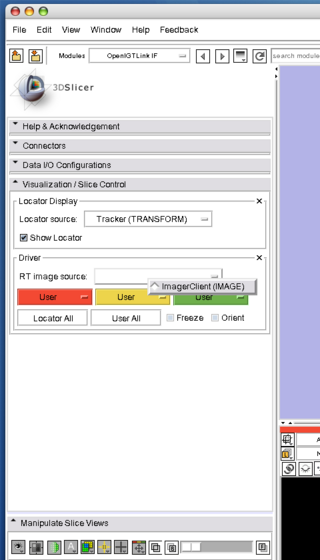 Slicer3 OpenIGTLinkIF ImagePlaneSetting1.png
