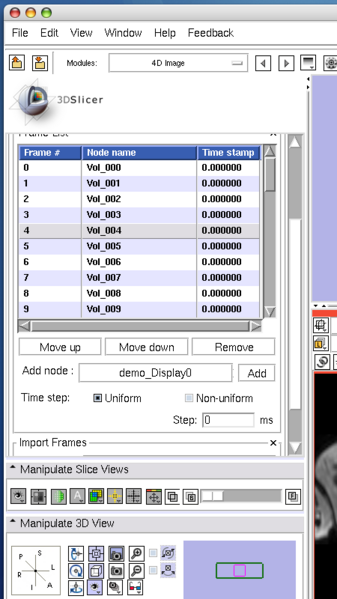 File:FourDImage EditSelection.png
