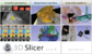 Slicer4Announcement-HiRes.png