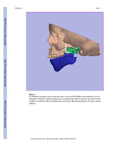 File:Lindig-HistochemCellBiol2009-fig6.pdf